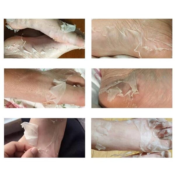 Sunup SN-26965 Ayak Peeling Maskesi (Nasır, Ölü Deri, Egzama Giderici)